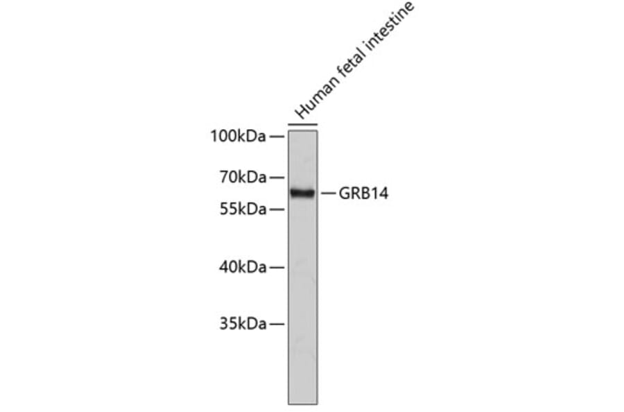 Western Blot - Anti-GRB14 Antibody (A14163) - Antibodies.com