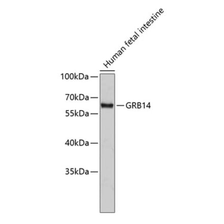 Western Blot - Anti-GRB14 Antibody (A14163) - Antibodies.com