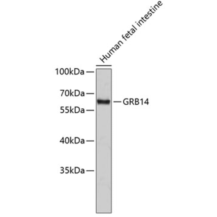 Western Blot - Anti-GRB14 Antibody (A14163) - Antibodies.com