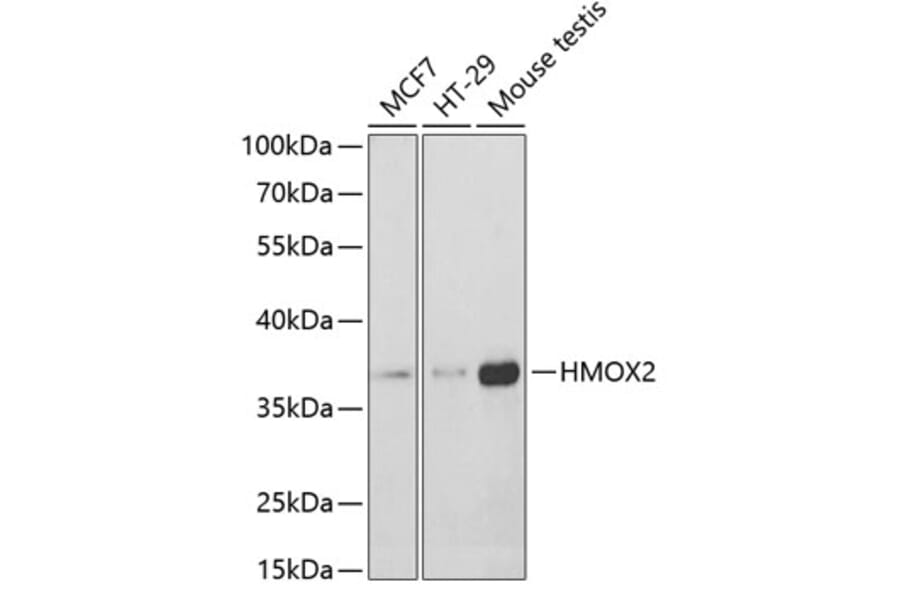 Western Blot - Anti-HO-2 Antibody (A14164) - Antibodies.com