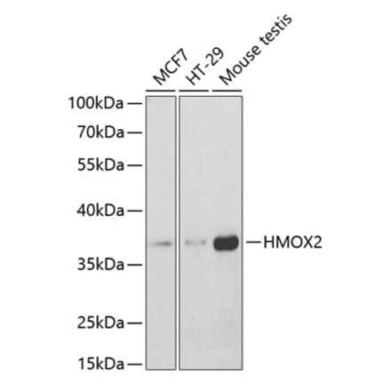 Western Blot - Anti-HO-2 Antibody (A14164) - Antibodies.com