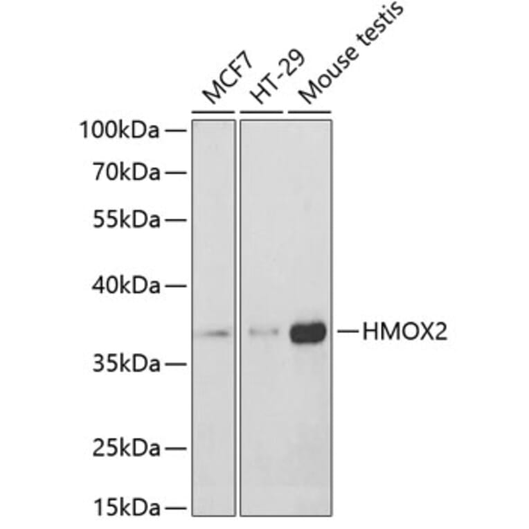 Western Blot - Anti-HO-2 Antibody (A14164) - Antibodies.com