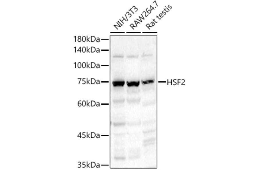 Western Blot - Anti-HSF2 Antibody (A14166) - Antibodies.com
