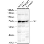 Western Blot - Anti-HSF2 Antibody (A14166) - Antibodies.com