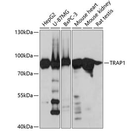 Western Blot - Anti-TRAP1 Antibody (A14167) - Antibodies.com
