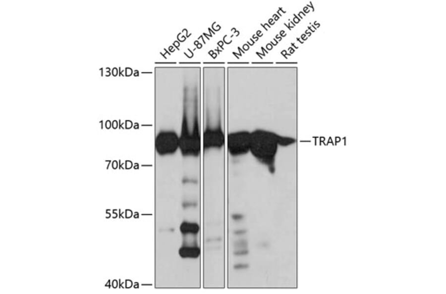 Western Blot - Anti-TRAP1 Antibody (A14167) - Antibodies.com