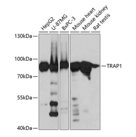 Western Blot - Anti-TRAP1 Antibody (A14167) - Antibodies.com
