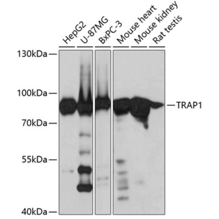 Western Blot - Anti-TRAP1 Antibody (A14167) - Antibodies.com