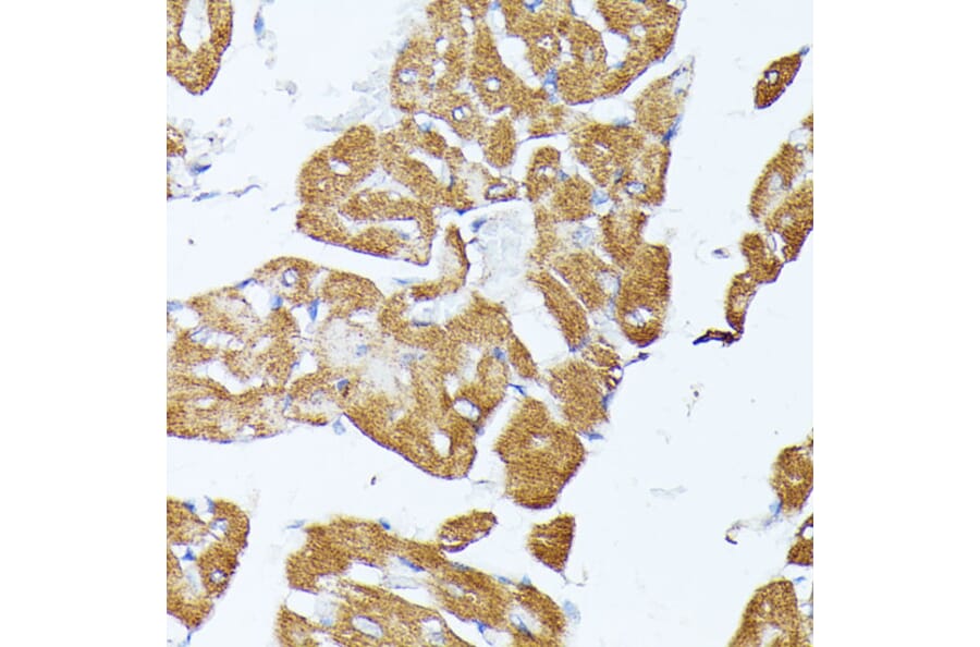 Immunohistochemistry - Anti-TRAP1 Antibody (A14167) - Antibodies.com
