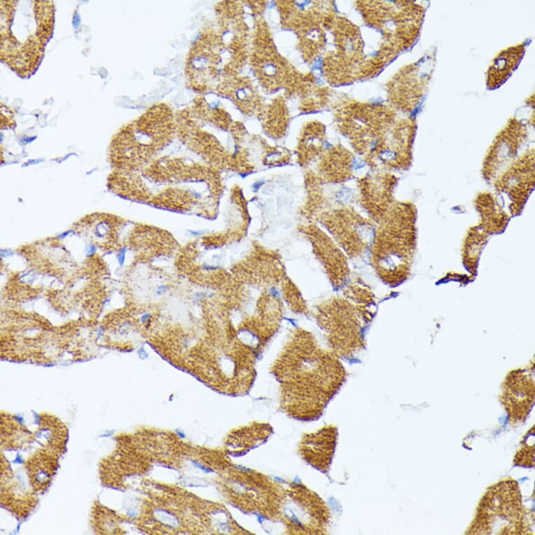 Immunohistochemistry - Anti-TRAP1 Antibody (A14167) - Antibodies.com