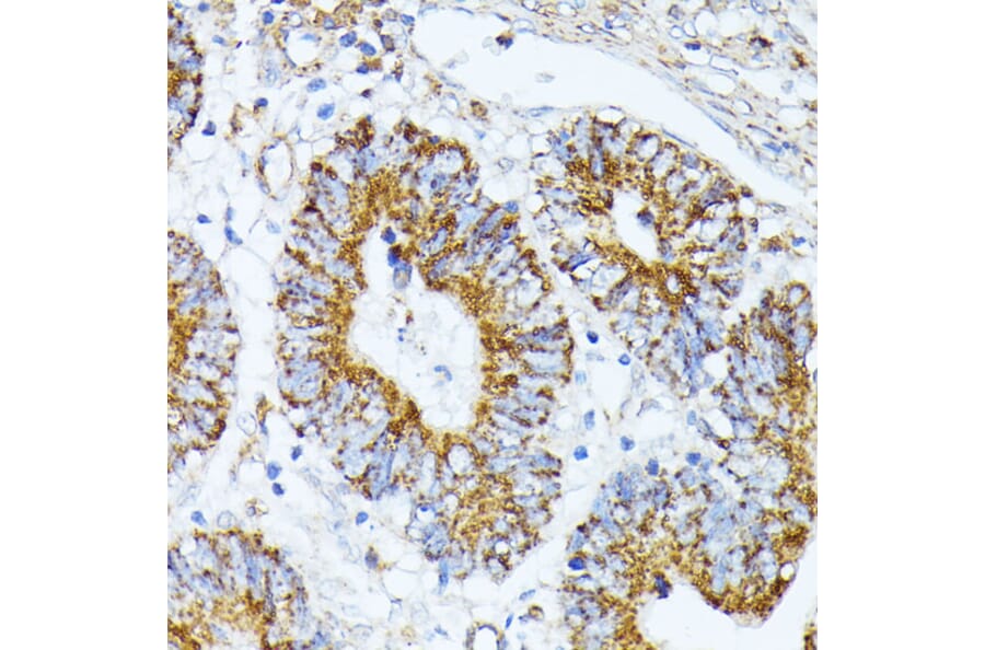 Immunohistochemistry - Anti-TRAP1 Antibody (A14167) - Antibodies.com