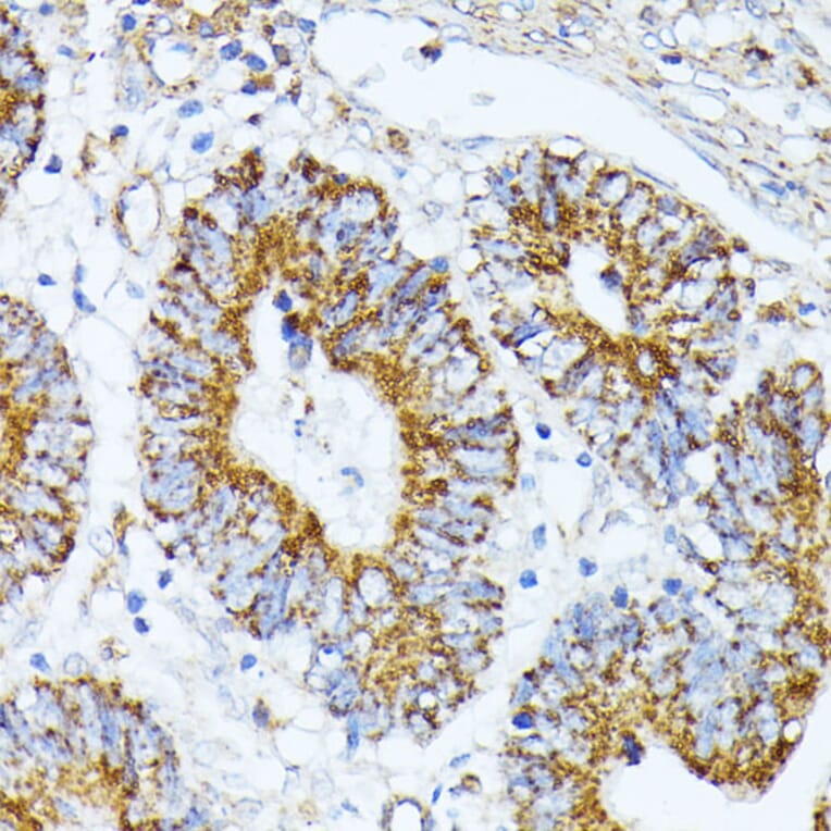 Immunohistochemistry - Anti-TRAP1 Antibody (A14167) - Antibodies.com