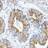 Immunohistochemistry - Anti-TRAP1 Antibody (A14167) - Antibodies.com