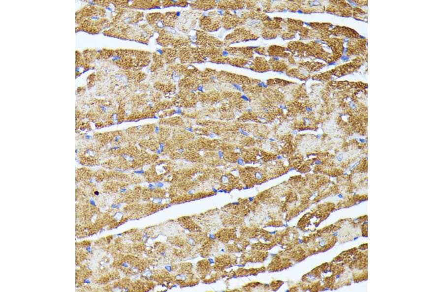 Immunohistochemistry - Anti-TRAP1 Antibody (A14167) - Antibodies.com