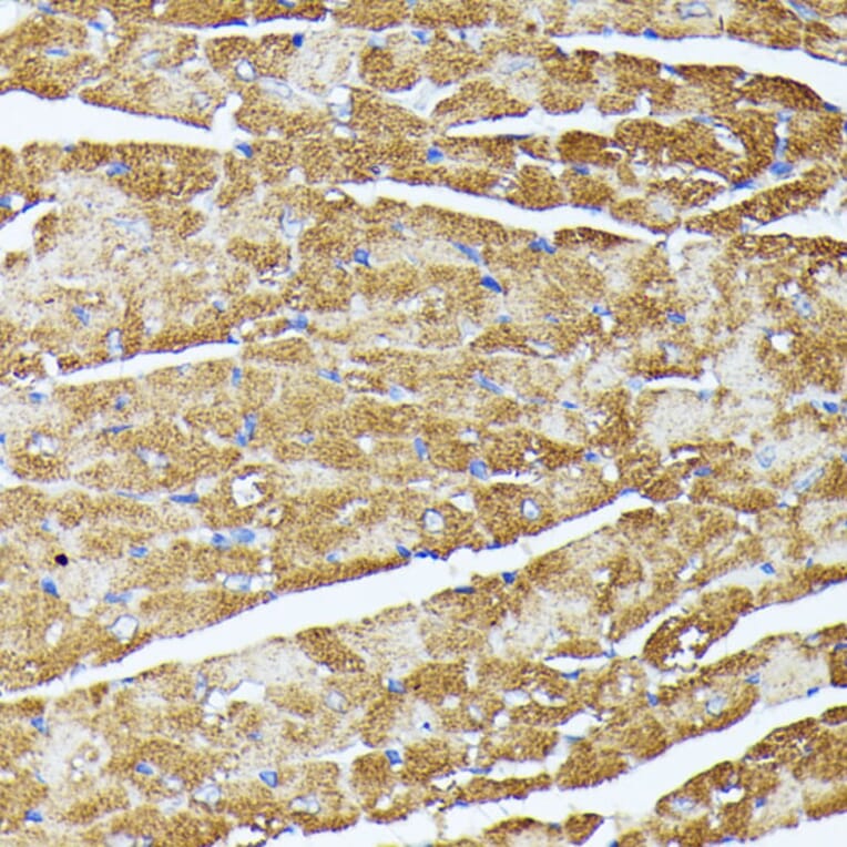 Immunohistochemistry - Anti-TRAP1 Antibody (A14167) - Antibodies.com