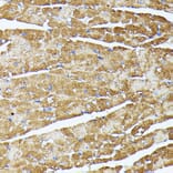 Immunohistochemistry - Anti-TRAP1 Antibody (A14167) - Antibodies.com