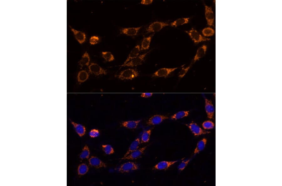 Immunofluorescence - Anti-TRAP1 Antibody (A14167) - Antibodies.com