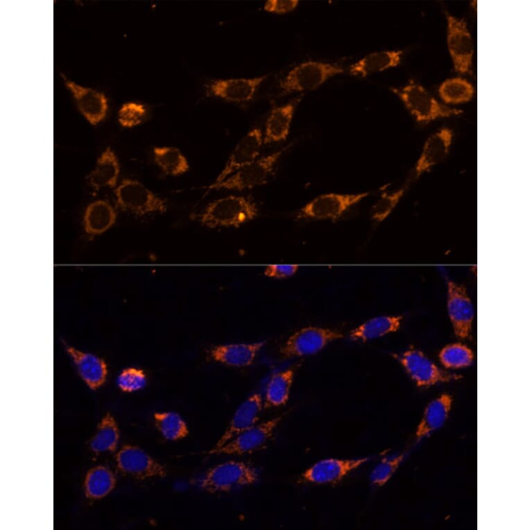 Immunofluorescence - Anti-TRAP1 Antibody (A14167) - Antibodies.com
