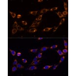 Immunofluorescence - Anti-TRAP1 Antibody (A14167) - Antibodies.com