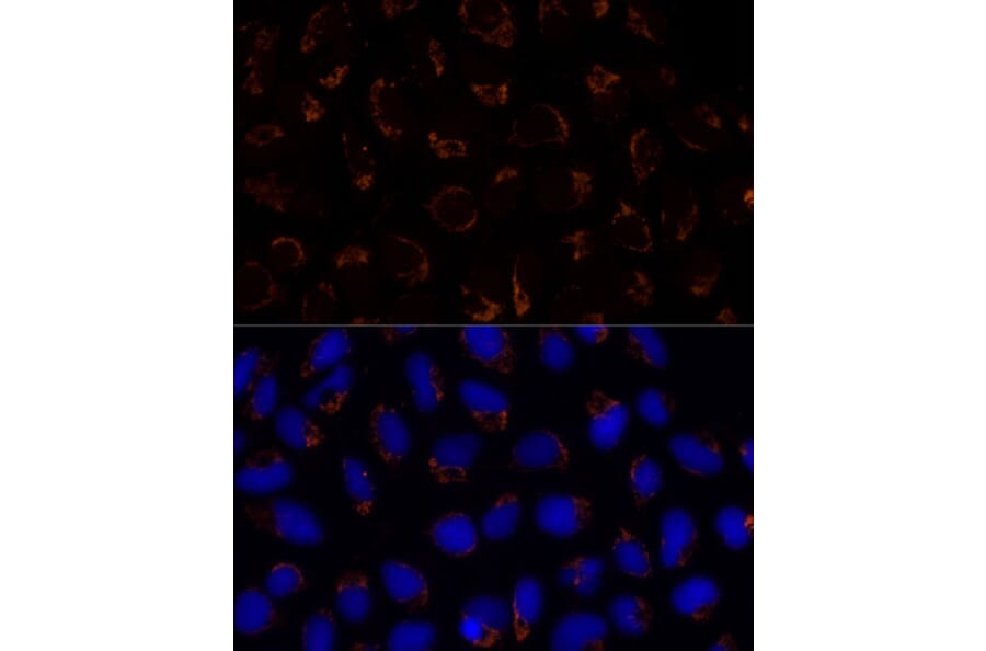Immunofluorescence - Anti-TRAP1 Antibody (A14167) - Antibodies.com
