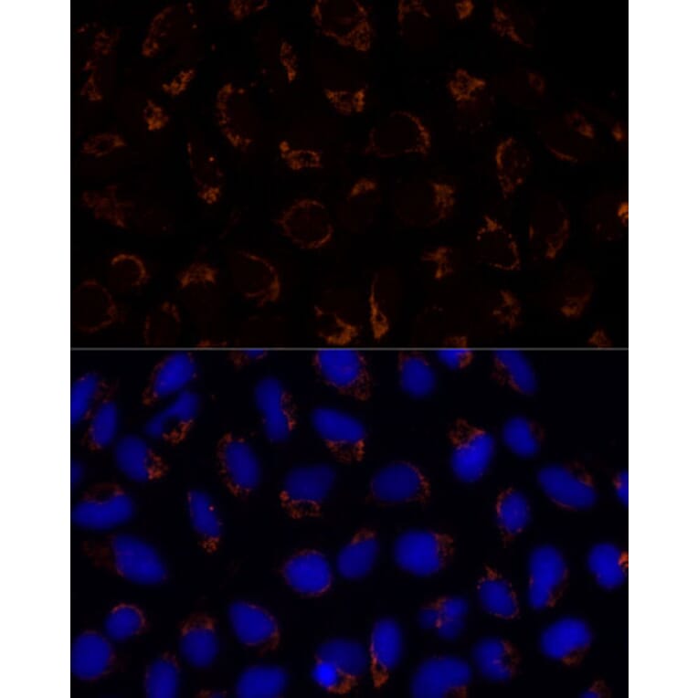 Immunofluorescence - Anti-TRAP1 Antibody (A14167) - Antibodies.com
