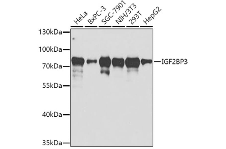 Western Blot - Anti-IMP3 Antibody (A14168) - Antibodies.com
