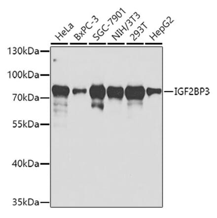 Western Blot - Anti-IMP3 Antibody (A14168) - Antibodies.com