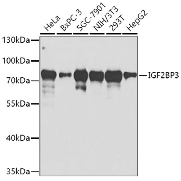 Western Blot - Anti-IMP3 Antibody (A14168) - Antibodies.com