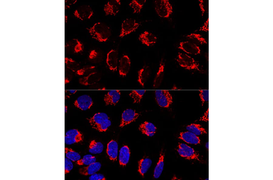 Immunofluorescence - Anti-Mitofilin Antibody (A14169) - Antibodies.com