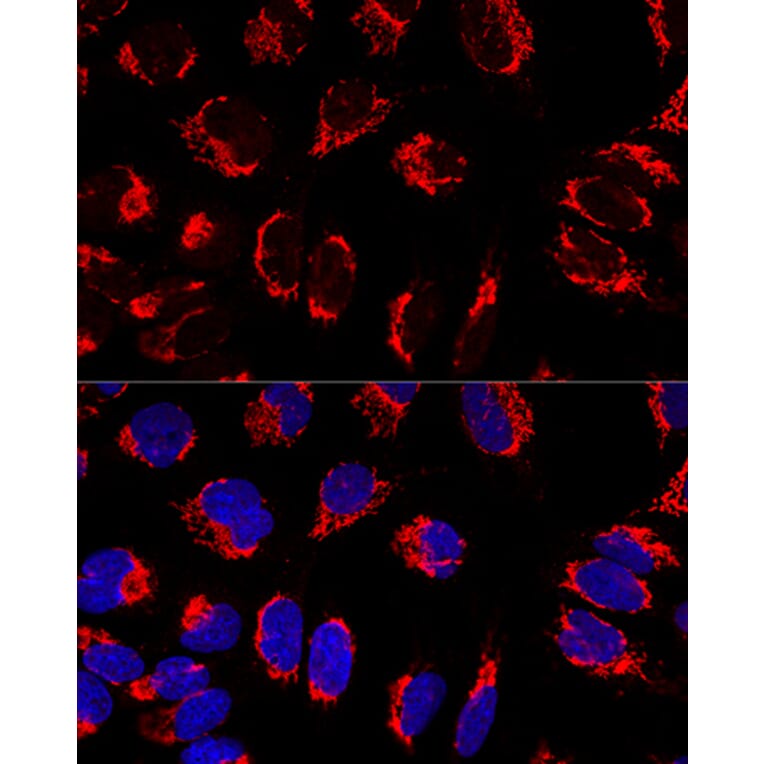 Immunofluorescence - Anti-Mitofilin Antibody (A14169) - Antibodies.com