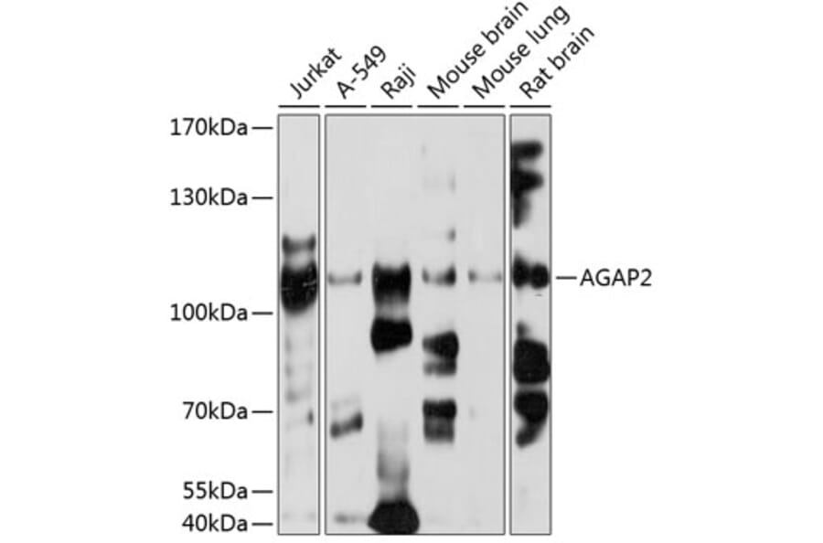 Western Blot - Anti-AGAP2 Antibody (A2759) - Antibodies.com