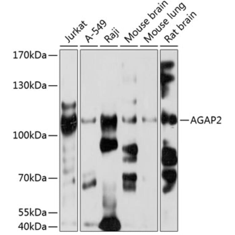 Western Blot - Anti-AGAP2 Antibody (A2759) - Antibodies.com