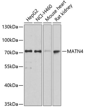 Western blot analysis of extracts of various cell lines, using Anti-MATN4 Antibody (A2761) at 1:3000 dilution.
Secondary antibody: Goat Anti-Rabbit IgG (H+L) (HRP) (AS014) at 1:10,000 dilution.
Lysates / proteins: 25µg per lane.
Blocking buffer: 3% non-fat dry milk in TBST.
Detection: ECL Basic Kit (RM00020).
Exposure time: 10s.