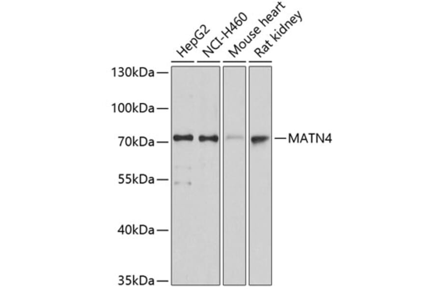 Western Blot - Anti-MATN4 Antibody (A14173) - Antibodies.com