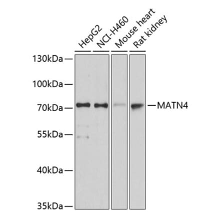 Western Blot - Anti-MATN4 Antibody (A14173) - Antibodies.com