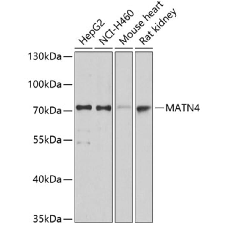 Western Blot - Anti-MATN4 Antibody (A14173) - Antibodies.com