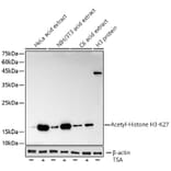 Western Blot - Anti-Histone H3 (acetyl Lys27) Antibody [ARC53670] (A14181) - Antibodies.com