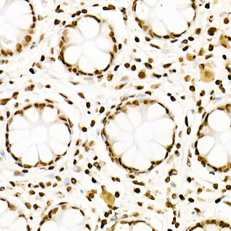 Immunohistochemistry - Anti-Histone H3 (acetyl Lys27) Antibody [ARC53670] (A14181) - Antibodies.com