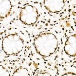 Immunohistochemistry - Anti-Histone H3 (acetyl Lys27) Antibody [ARC53670] (A14181) - Antibodies.com