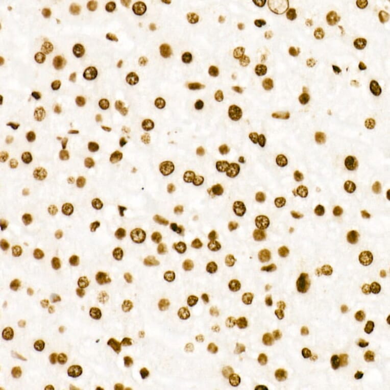 Immunohistochemistry - Anti-Histone H3 (acetyl Lys27) Antibody [ARC53670] (A14181) - Antibodies.com