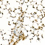 Immunohistochemistry - Anti-Histone H3 (acetyl Lys27) Antibody [ARC53670] (A14181) - Antibodies.com