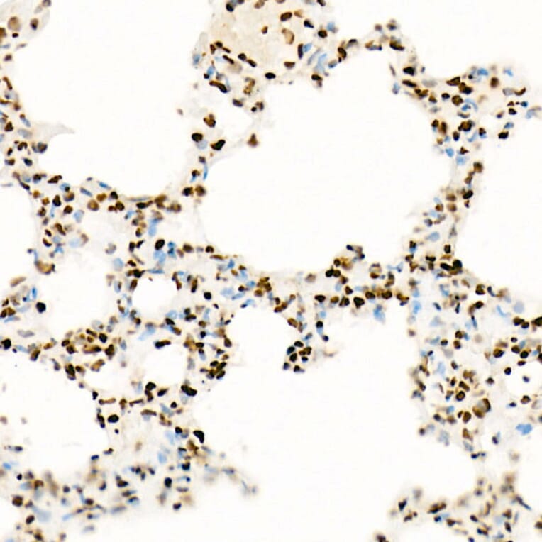 Immunohistochemistry - Anti-Histone H3 (acetyl Lys27) Antibody [ARC53670] (A14181) - Antibodies.com