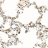 Immunohistochemistry - Anti-Histone H3 (acetyl Lys27) Antibody [ARC53670] (A14181) - Antibodies.com