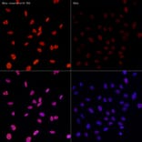 Immunofluorescence - Anti-Histone H3 (acetyl Lys27) Antibody [ARC53670] (A14181) - Antibodies.com