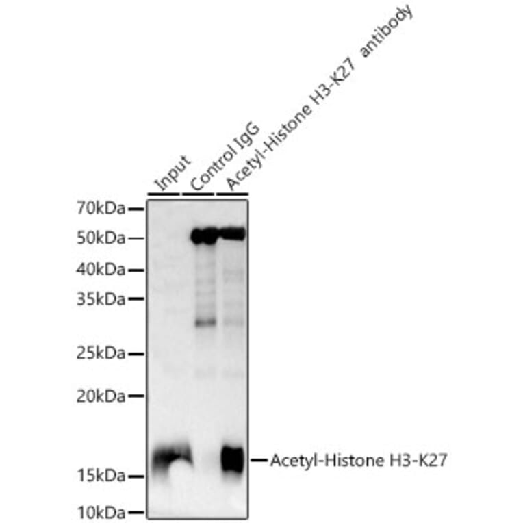 Western Blot - Anti-Histone H3 (acetyl Lys27) Antibody [ARC53670] (A14181) - Antibodies.com