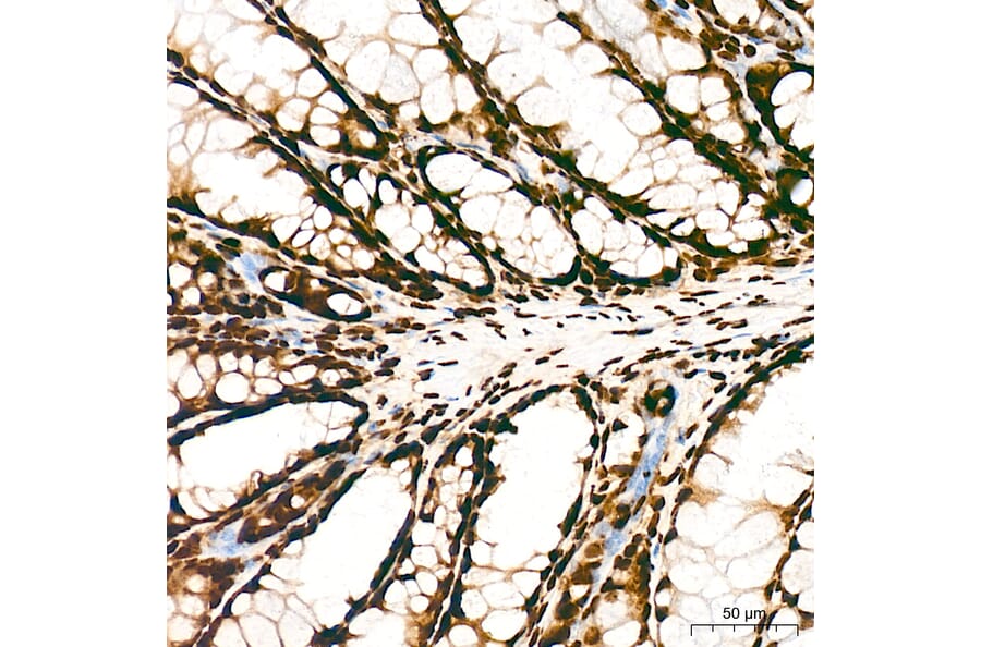 Chromatin Immunoprecipitation - Anti-Histone H3 (acetyl Lys27) Antibody (A14181) - Antibodies.com