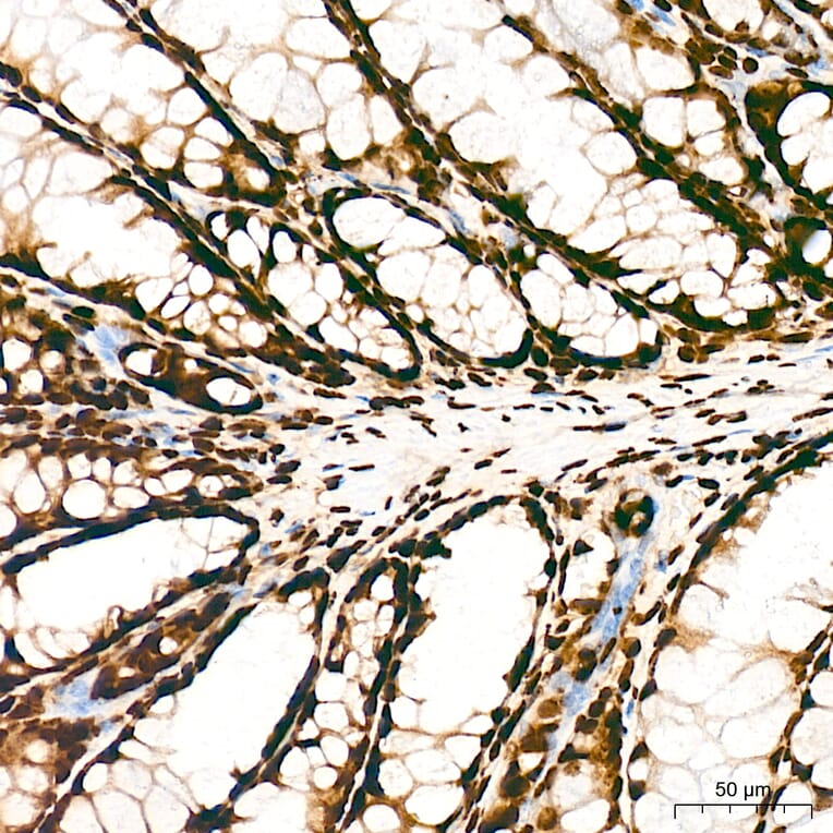 Chromatin Immunoprecipitation - Anti-Histone H3 (acetyl Lys27) Antibody (A14181) - Antibodies.com