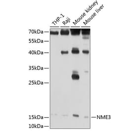 Western Blot - Anti-NME3 Antibody (A14183) - Antibodies.com