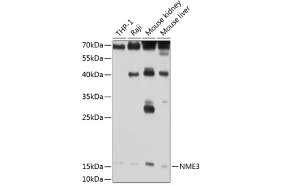 Western Blot - Anti-NME3 Antibody (A14183) - Antibodies.com