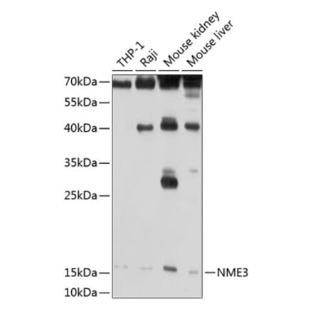 Western Blot - Anti-NME3 Antibody (A14183) - Antibodies.com